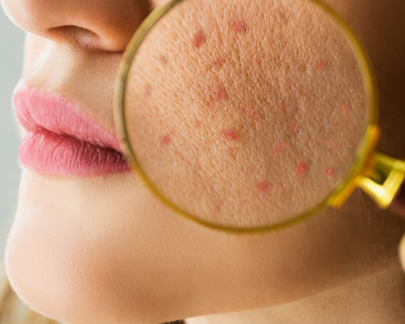 Consulta dermatológica em Curitiba com especialista da THA Dermatologia para cuidar da saúde da pele